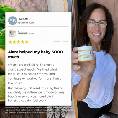 Alaré Honey Skin Soothing Cream