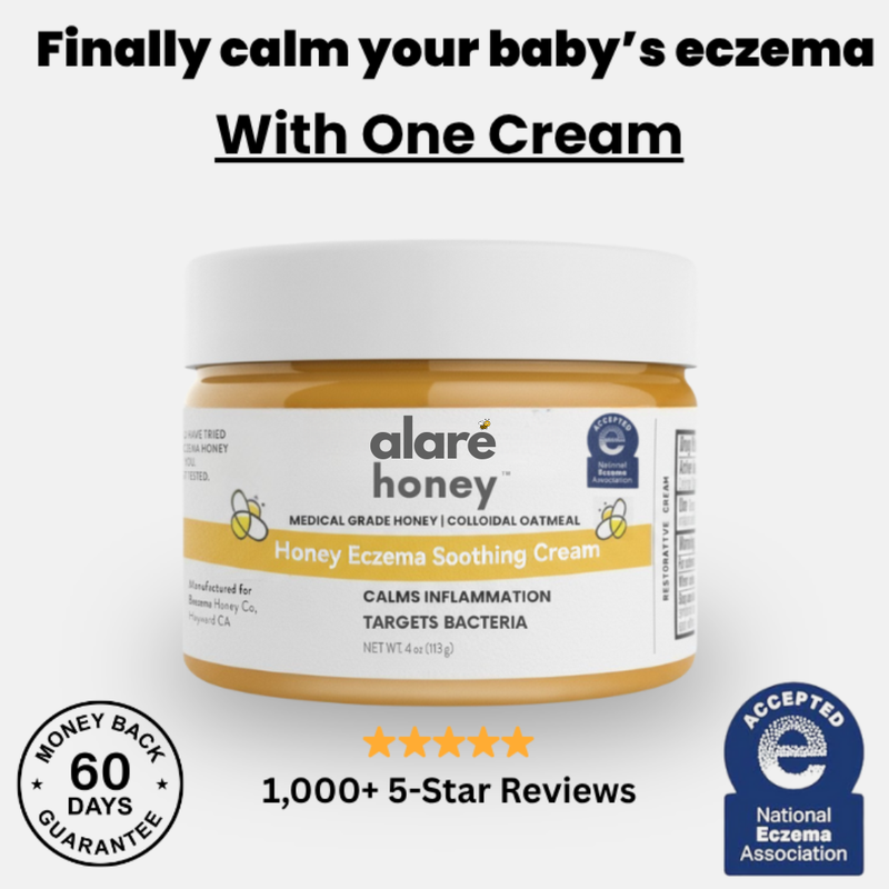 Finally Calm Your Baby's Eczema