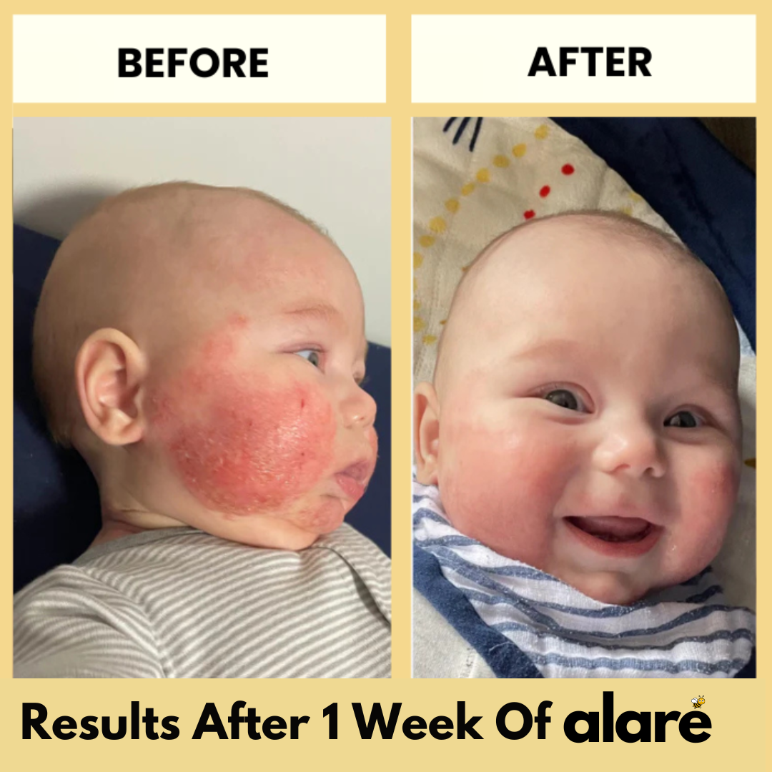 Alaré Honey Skin Soothing Cream