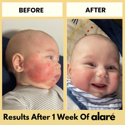 Alaré Honey Skin Soothing Cream