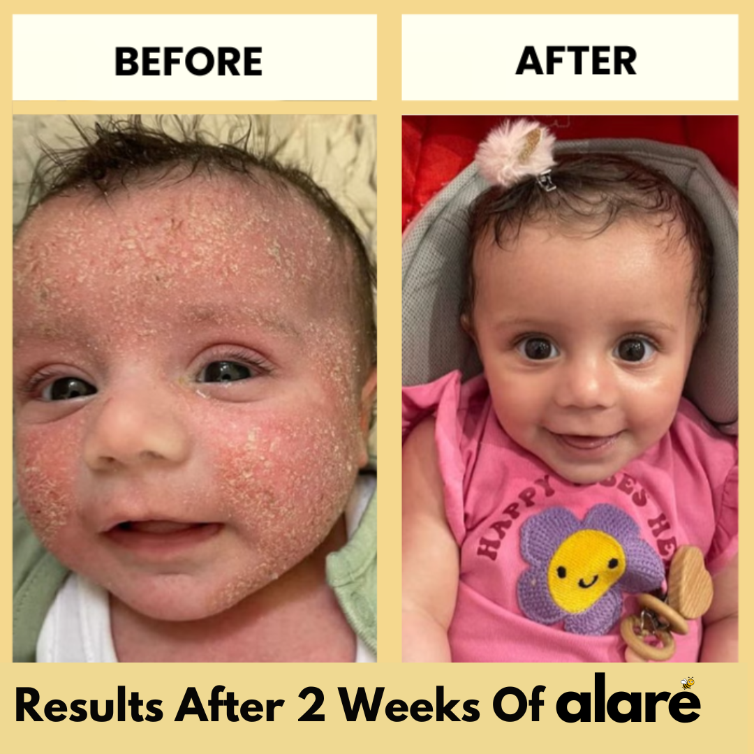 Alaré Honey Skin Soothing Cream