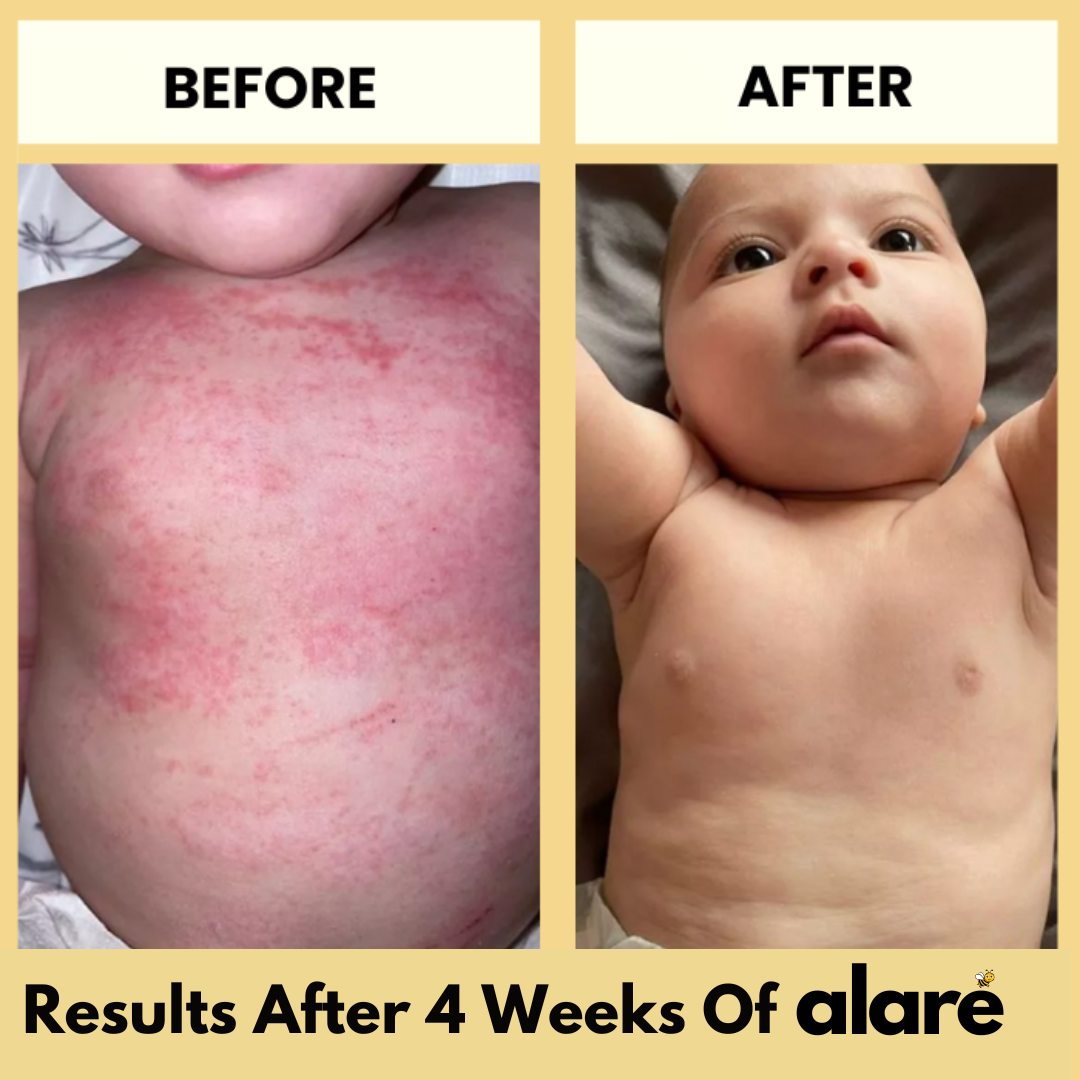 Alaré Honey Skin Soothing Cream