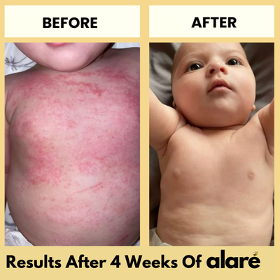 Alaré Honey Skin Soothing Cream